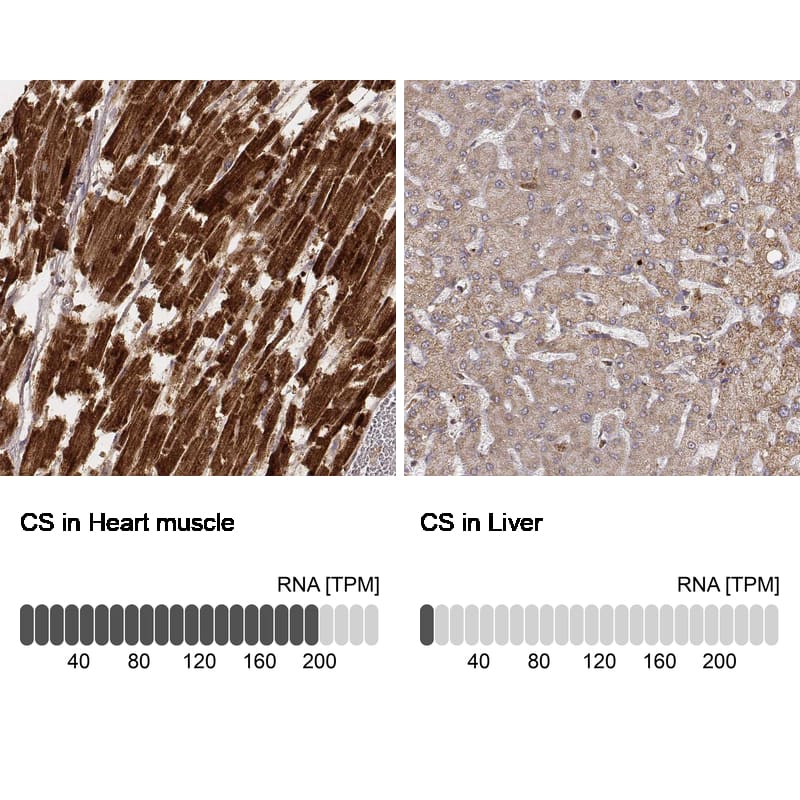Analysis in human heart muscle and liver tissues using NBP3-44450 antibody. Corresponding CS Citrate Synthase RNA-seq data are presented for the same tissues.