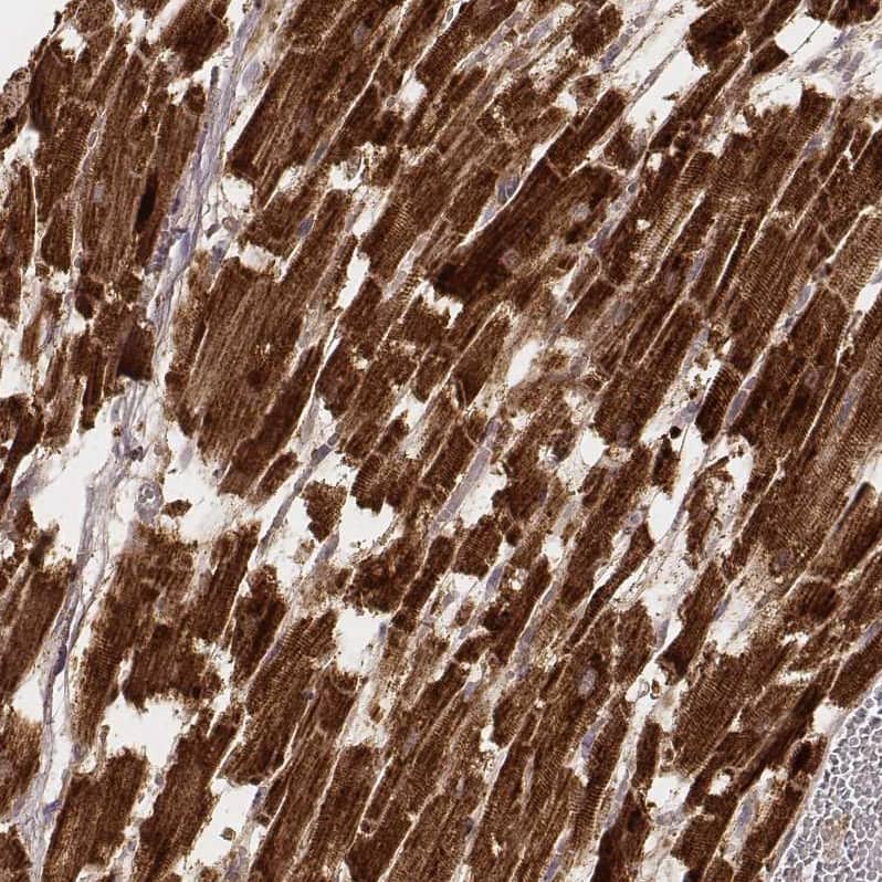Staining of human heart muscle shows strong cytoplasmic positivity in cardiomyocytes.