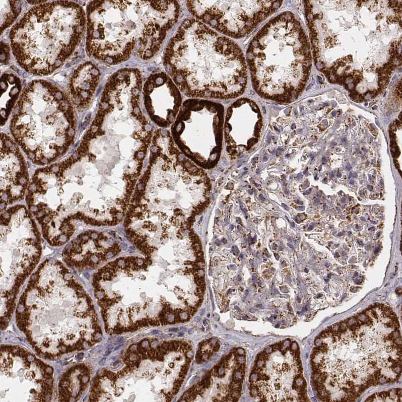 Staining of human kidney shows strong cytoplasmic positivity in cells in tubules.