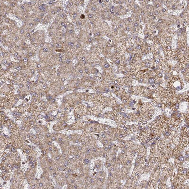 Staining of human liver shows negative to very weak positivity in hepatocytes.