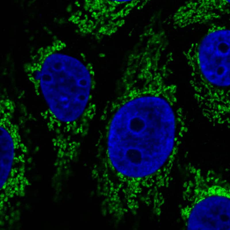 Staining in MCF7 cell line with Anti-CS Citrate Synthase monoclonal antibody) .