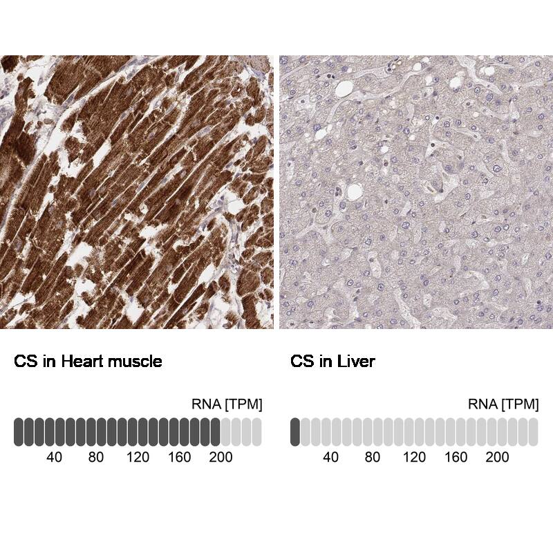 Analysis in human heart muscle and liver tissues using NBP3-44451 antibody. Corresponding CS Citrate Synthase RNA-seq data are presented for the same tissues.