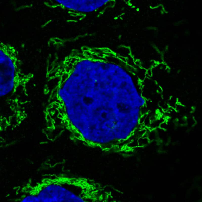 Staining in A431 cell line with Anti-CS Citrate Synthase monoclonal antibody) .