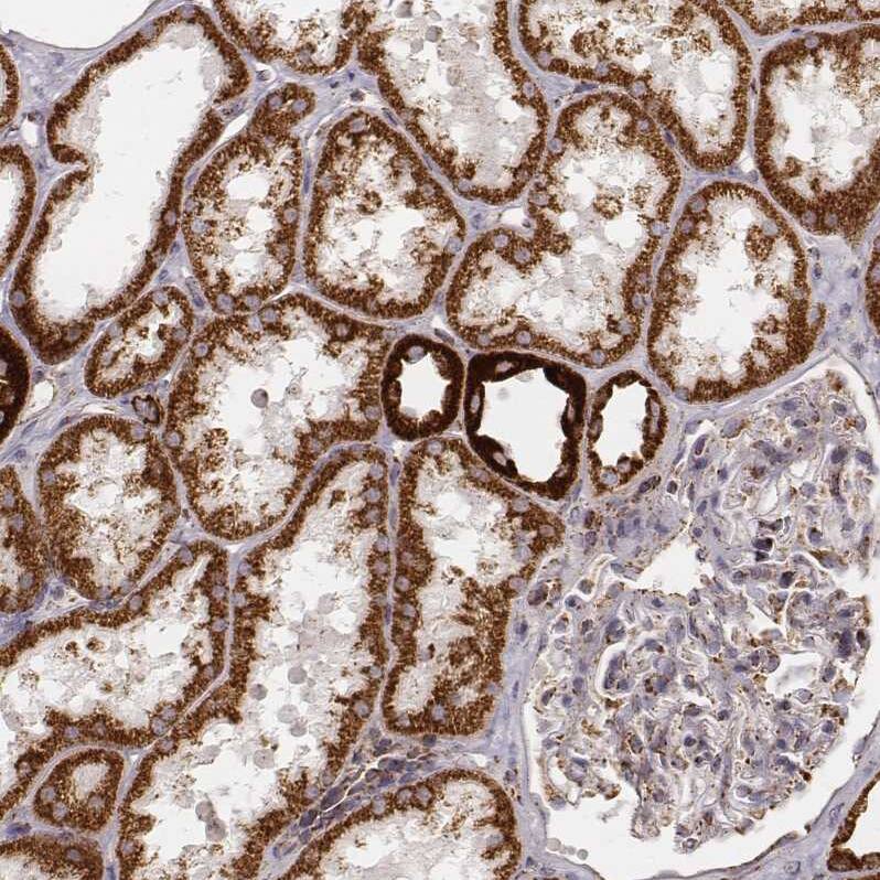 Staining of human kidney shows strong cytoplasmic positivity in cells in tubules.