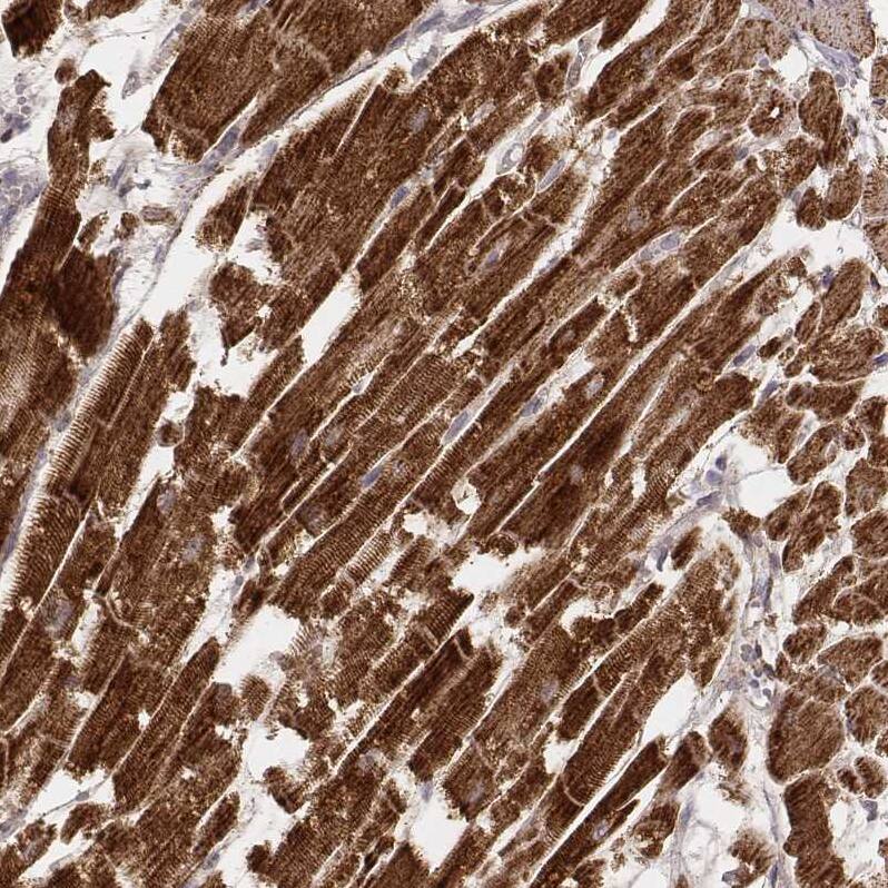 Staining of human heart muscle shows strong cytoplasmic positivity in cardiomyocytes.