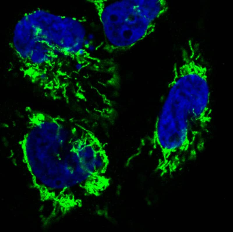 Staining in U251 cell line with Anti-CS Citrate Synthase monoclonal antibody) .