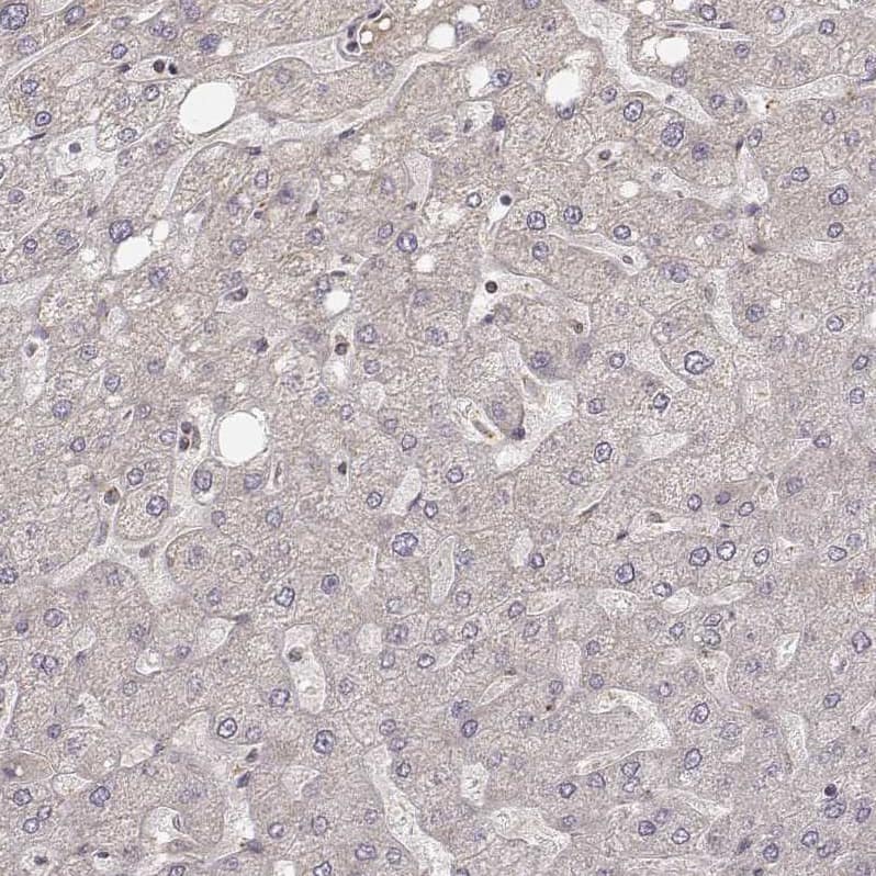 Staining of human liver shows no positivity in hepatocytes as expected.