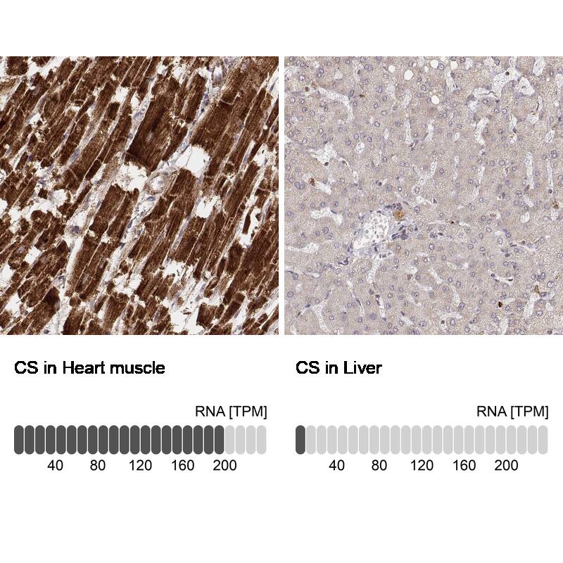 Analysis in human heart muscle and liver tissues using NBP3-44452 antibody. Corresponding CS Citrate Synthase RNA-seq data are presented for the same tissues.