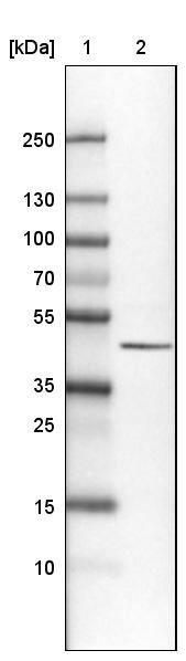 Lane 1: Marker [kDa]Lane 2: Human cell line U-251 MG