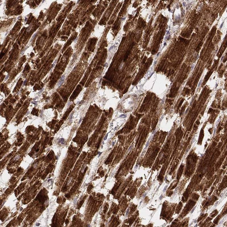 Staining of human heart muscle shows strong cytoplasmic positivity in cardiomyocytes.