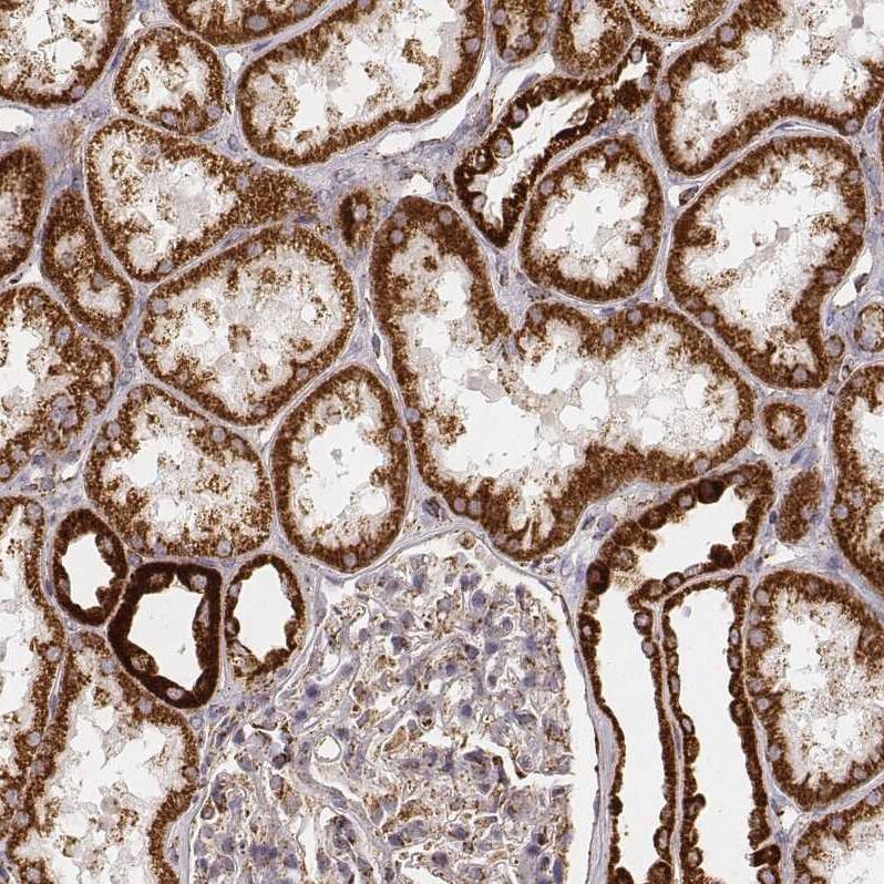 Staining of human kidney shows strong cytoplasmic positivity in cells in tubules.