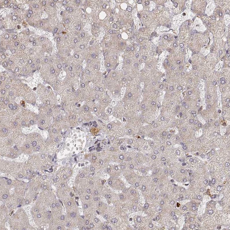 Staining of human liver shows no positivity in hepatocytes as expected.