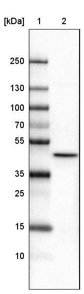 Lane 1: Marker [kDa]Lane 2:Human cell line U-251 MG