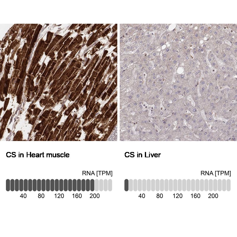 Analysis in human heart muscle and liver tissues using NBP3-44453 antibody. Corresponding CS Citrate Synthase RNA-seq data are presented for the same tissues.
