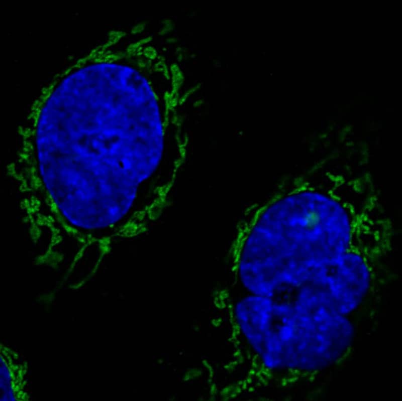 Staining in A431 cell line with Anti-CS Citrate Synthase monoclonal antibody) .
