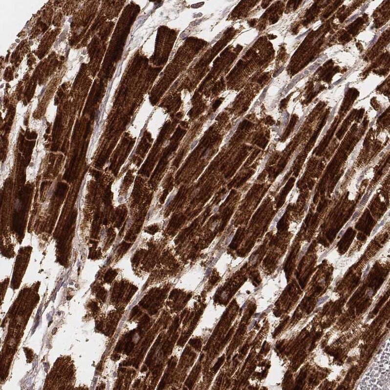 Staining of human heart muscle shows strong cytoplasmic positivity in cardiomyocytes.