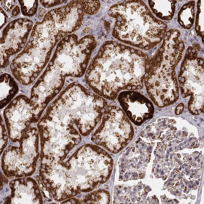 Staining of human kidney shows strong cytoplasmic positivity in cells in tubules.