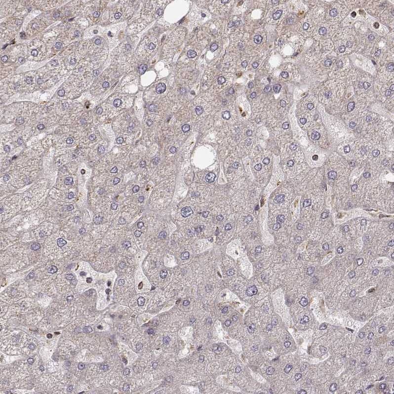 Staining of human liver shows no positivity in hepatocytes as expected.