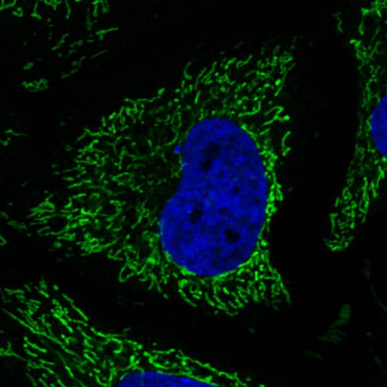Staining in HeLa cell line with Anti-CS Citrate Synthase monoclonal antibody) .