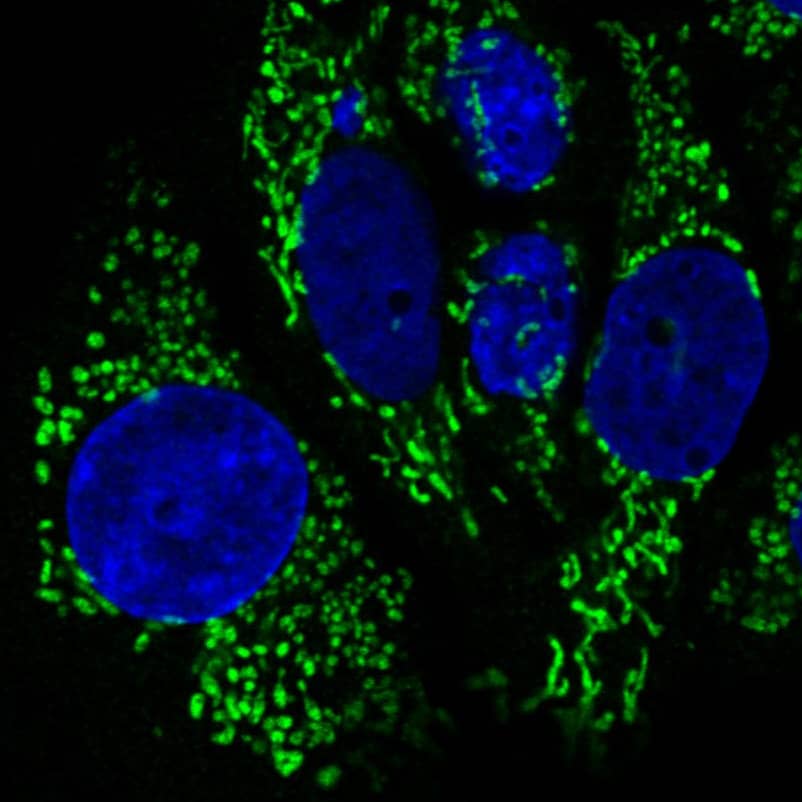 Staining in MCF7 cell line with Anti-CS Citrate Synthase monoclonal antibody) .