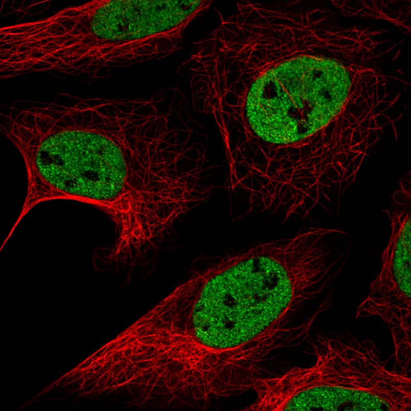 Staining in U2OS cell line with Anti-hnRNP C1 + C2 monoclonal antibody) staining in green. Microtubule- and nuclear probes are visualized in red and blue respectively (where available).