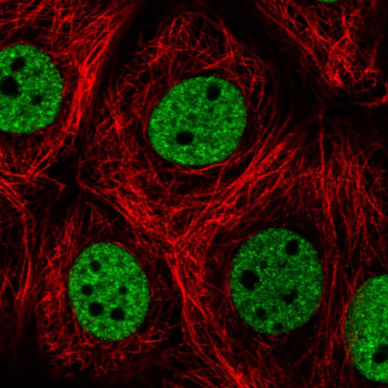 Staining in MCF7 cell line with Anti-hnRNP C1 + C2 monoclonal antibody) staining in green. Microtubule- and nuclear probes are visualized in red and blue respectively (where available).