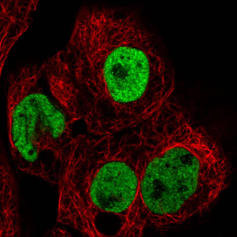 Staining in A431 cell line with Anti-hnRNP C1 + C2 monoclonal antibody) staining in green. Microtubule- and nuclear probes are visualized in red and blue respectively (where available).