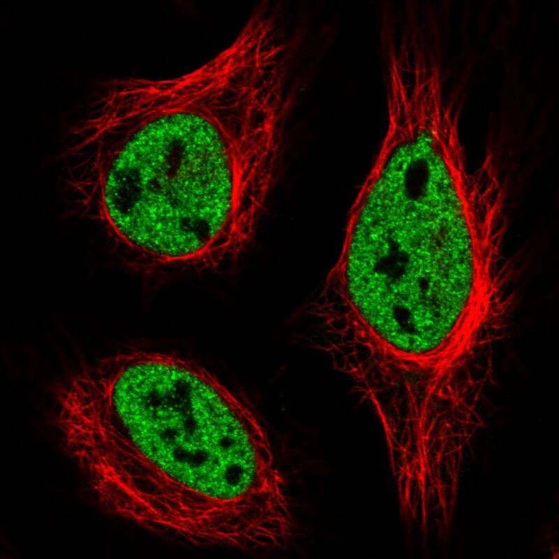 Staining in HeLa cell line with Anti-hnRNP C1 + C2 monoclonal antibody) staining in green. Microtubule- and nuclear probes are visualized in red and blue respectively (where available).