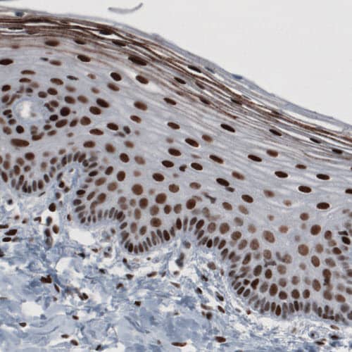 Staining of human cervix shows strong nuclear immunoreactivity.