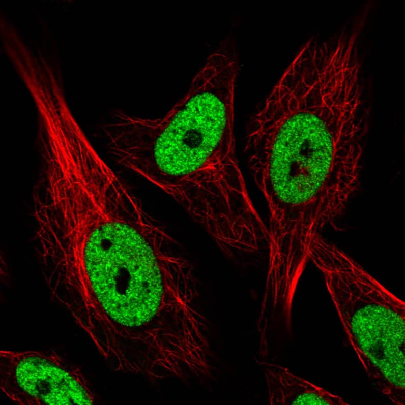 Staining in U251 cell line with Anti-hnRNP C1 + C2 monoclonal antibody) staining in green. Microtubule- and nuclear probes are visualized in red and blue respectively (where available).