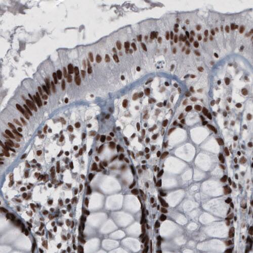 Staining of human rectum shows strong nuclear positivity in glandular and lamina propria cells.