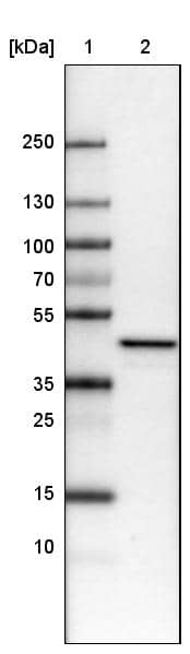 Lane 1: Marker [kDa]Lane 2: Human cell line U-251 MG