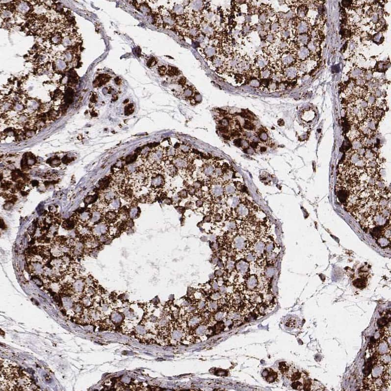 Staining of human testis shows strong granular cytoplasmic positivity in cells in seminiferous ducts, as well as in Leydig cells.