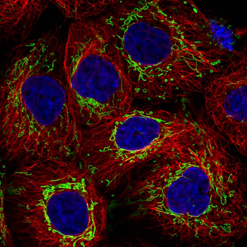 Staining in A431 cell line with Anti-TUFM monoclonal antibody) .