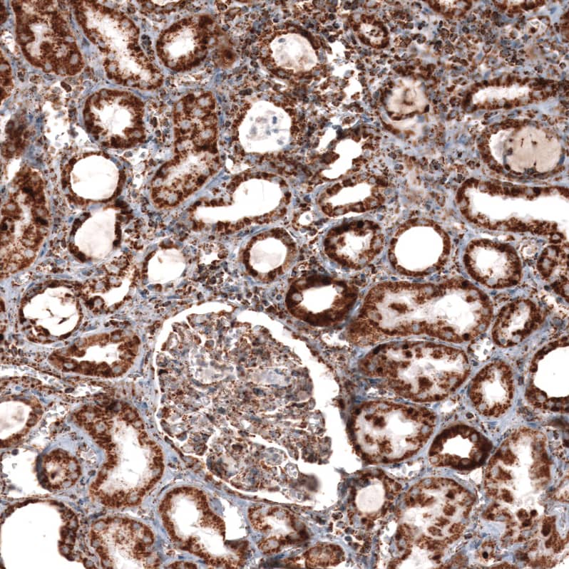 Staining of human kidney shows strong granular cytoplasmic positivity in cells in tubules.