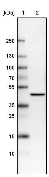 Lane 1: Marker [kDa]Lane 2: Human cell line U-251 MG