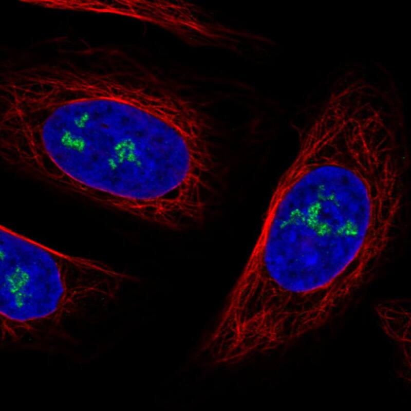 Staining in U2OS cell line with Anti-NOP56 monoclonal antibody) .