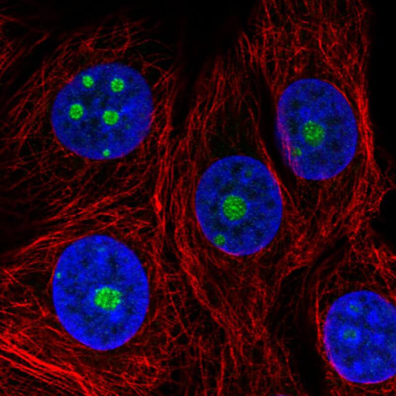 Staining in MCF7 cell line with Anti-NOP56 monoclonal antibody) .