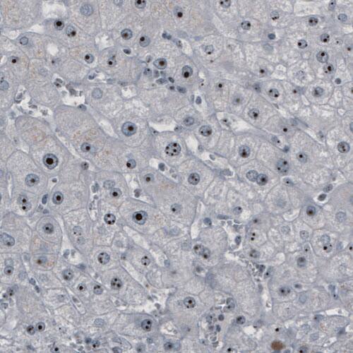 Staining of human liver shows strong nucleolar positivity in hepatocytes.