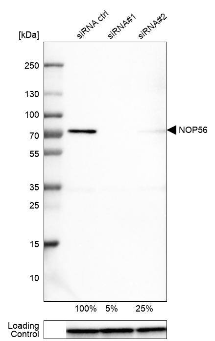 Analysis in U-251MG cells transfected with control siRNA, target specific siRNA probe #1 and #2, using Anti-NOP56 antibody. Remaining relative intensity is presented. Loading control: Anti-GAPDH.