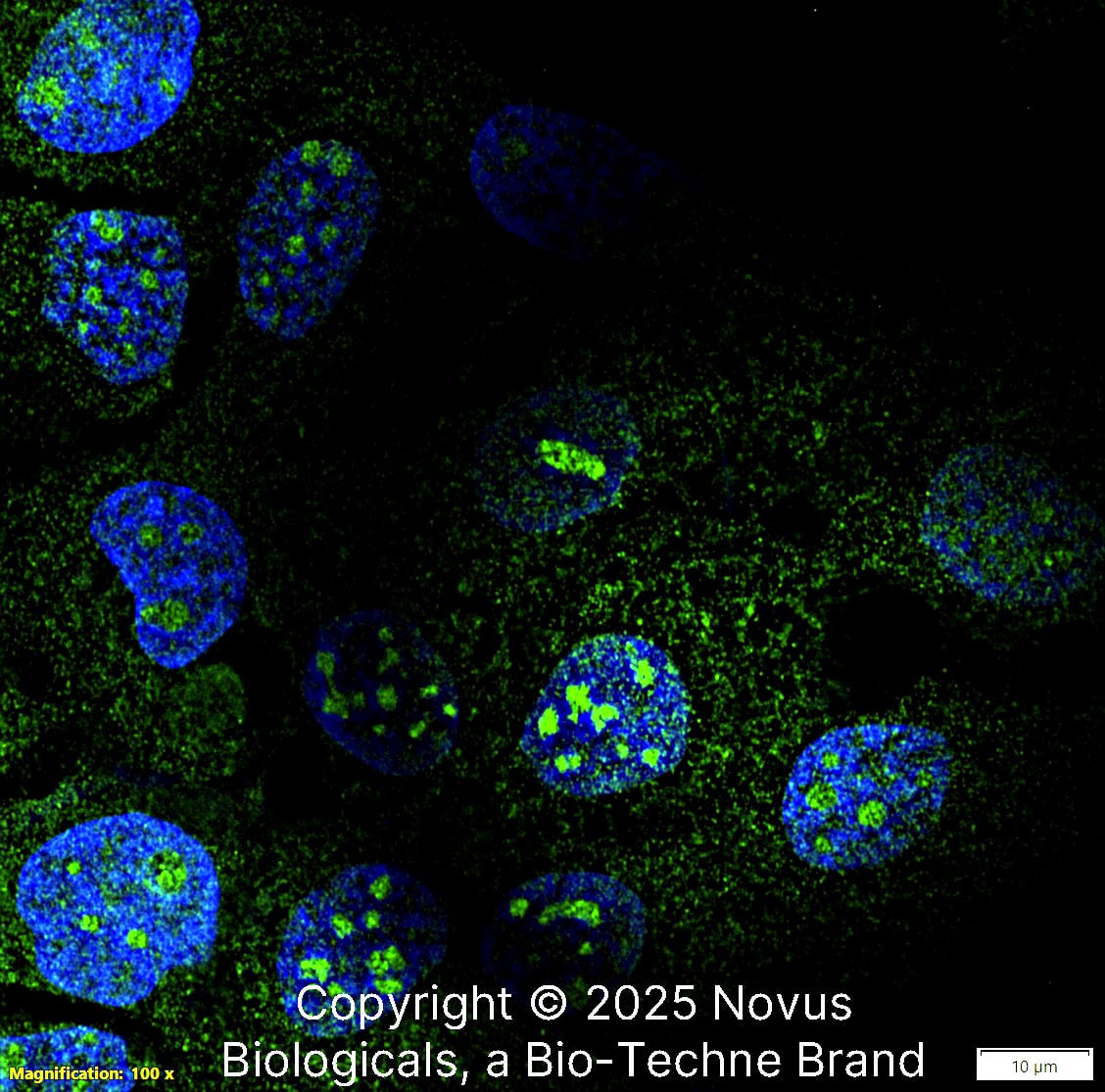 NOP56 (CL2603) was detected in immersion fixed A431 human skin carcinoma cell line using Mouse anti-NOP56 (CL2603) Protein A Purified Monoclonal Antibody conjugated to Alexa Fluor® 488 (Catalog # NBP3-44458AF488) (green) at 2 µg/mL overnight at 4C. Cells were counterstained with DAPI (blue). Cells were imaged using a 100X objective and digitally deconvolved.