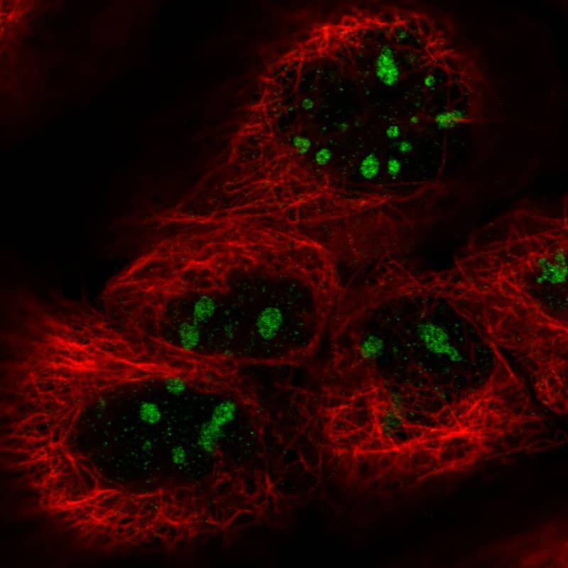 Staining in A431 cell line with Anti-MKI67IP monoclonal antibody) .