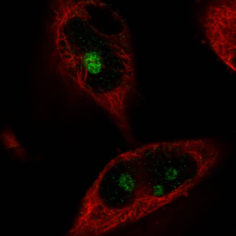 Staining in U251 cell line with Anti-MKI67IP monoclonal antibody) .