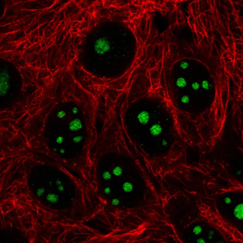 Staining in MCF7 cell line with Anti-MKI67IP monoclonal antibody) .