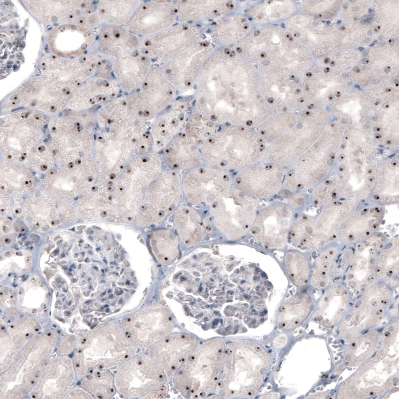 Staining of human kidney shows strong nucleolar positivity in cells in tubules.