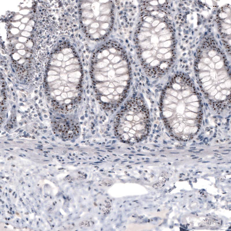 Staining of human colon strong nucleolar positivity in glandular cells.
