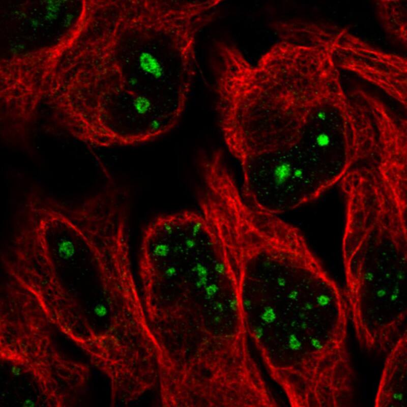 Staining in U2OS cell line with Anti-MKI67IP monoclonal antibody) .