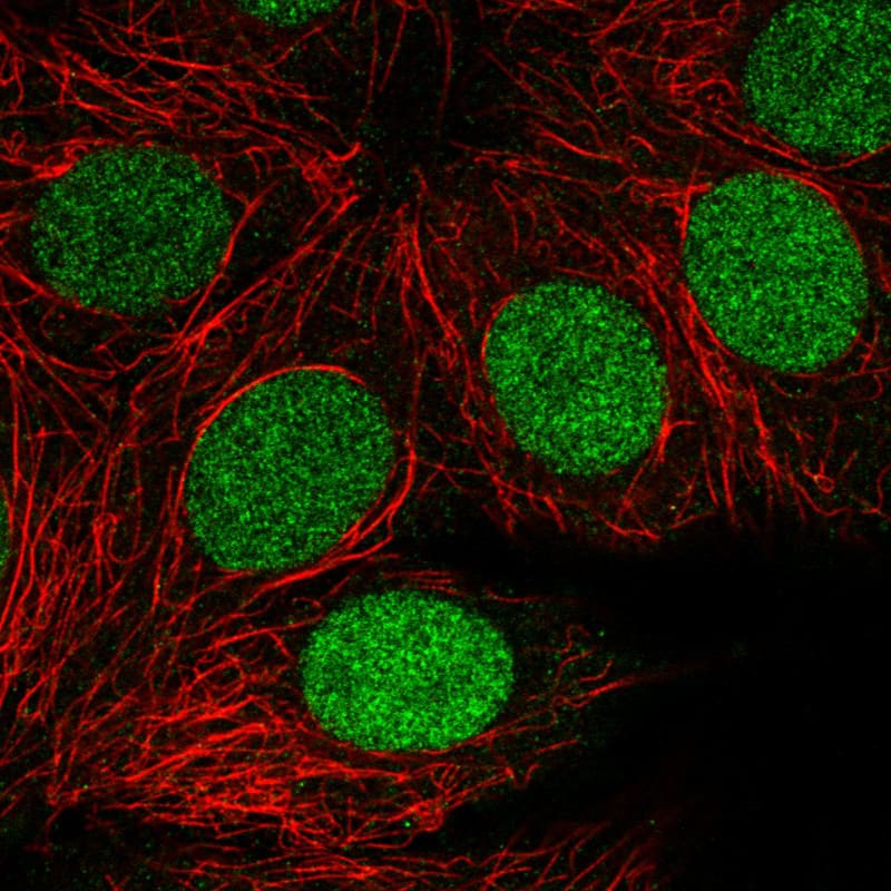 Staining in MCF7 cell line with Anti-PARP monoclonal antibody) .