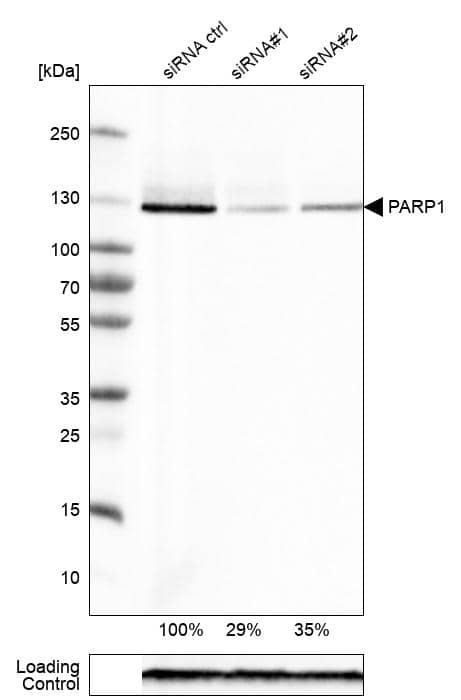 Analysis in RT-4 cells transfected with control siRNA, target specific siRNA probe #1 and #2, using Anti-PARP antibody. Remaining relative intensity is presented. Loading control: Anti-GAPDH.