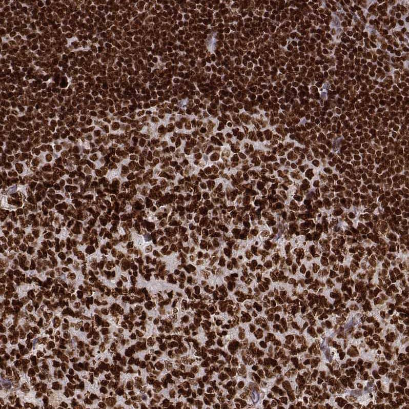 Staining of human tonsil shows strong nuclear positivity in lymphoid cells.